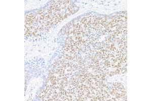 Immunohistochemistry (IHC) image for anti-Mediator Complex Subunit 1 (MED1) (AA 1550-1581) antibody (ABIN7455140) (Rekombinanter MED1 Antikörper  (AA 1550-1581))