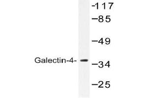 Western blot (WB) analysis of Galectin-4 antibody in extracts from COLO cells. (GAL4 Antikörper)