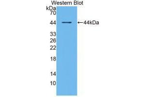 Western blot analysis of recombinant Human RANk. (TNFRSF11A Antikörper  (AA 330-615))
