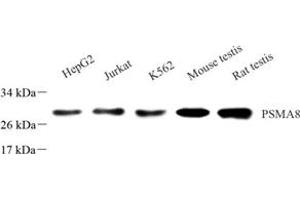 Western blot analysis of PSMA8 (ABIN7075232),at dilution of 1: 1000