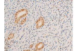 Immunohistochemistry (IHC) image for anti-Myc Proto-Oncogene protein (MYC) (pSer62) antibody (ABIN6255431)