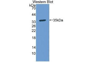 Western blot analysis of the recombinant protein. (PPOX Antikörper  (AA 9-300))