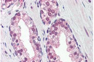 Human Prostate (formalin-fixed, paraffin-embedded) stained with REXO1 antibody ABIN364336 at 5 ug/ml followed by biotinylated anti-mouse IgG secondary antibody ABIN481714, alkaline phosphatase-streptavidin and chromogen. (REXO1 Antikörper  (AA 1060-1221))