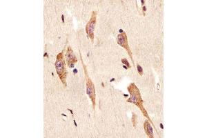 Antibody staining TGFBR2 in human brain sections by Immunohistochemistry (IHC-P - paraformaldehyde-fixed, paraffin-embedded sections). (TGFBR2 Antikörper  (N-Term))