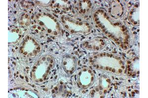 Immunohistochemistry (IHC) image for anti-Polypyrimidine Tract Binding Protein 1 (PTBP1) antibody (ABIN5874678) (PTBP1 Antikörper)