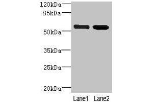 Western blot All lanes: EFCAB14 antibody at 4 μg/mL Lane 1: Colo320 whole cell lysate Lane 2: Hela whole cell lysate Secondary Goat polyclonal to rabbit IgG at 1/10000 dilution Predicted band size: 56 kDa Observed band size: 56 kDa (KIAA0494 Antikörper  (AA 1-483))