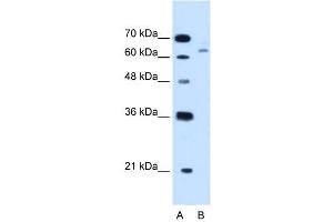 CBS antibody used at 1. (CBS Antikörper  (N-Term))