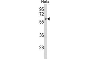 Western Blotting (WB) image for anti-Cytochrome P450, Family 7, Subfamily B, Polypeptide 1 (CYP7B1) antibody (ABIN3003910) (CYP7B1 Antikörper)