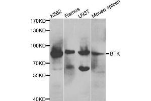Western blot analysis of extracts of various cell lines, using BTK antibody. (BTK Antikörper  (AA 30-240))