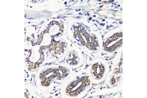 Immunohistochemistry of paraffin-embedded human breast using MMP16 antibody (ABIN6132356, ABIN6143906, ABIN6143907 and ABIN6214654) at dilution of 1:100 (40x lens).