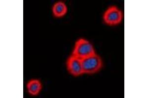 Immunofluorescent analysis of Cadherin 20 staining in HeLa cells.