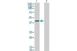 Western Blot analysis of SERPINA6 expression in transfected 293T cell line by SERPINA6 monoclonal antibody (M01), clone 1F11. (SERPINA6 Antikörper  (AA 23-405))
