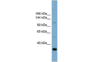 WB Suggested Anti-SLC9A1  Antibody Titration: 0. (SLC9A1 Antikörper  (Middle Region))