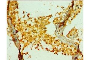 Immunohistochemistry of paraffin-embedded human testis tissue using ABIN7142036 at dilution of 1:100 (PIKFYVE Antikörper  (AA 1819-2098))