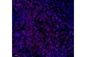 Immunofluorescence of paraffin embedded human tonsil using CD3 (ABIN7073386) at dilution of 1: 500 (200x lens)