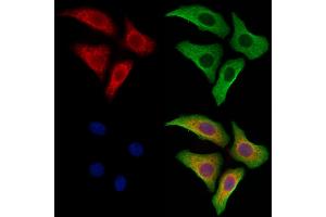 ABIN6262982 and ABIN6273264 staining Hela cells by IF/ICC.