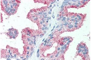 Immunohistochemistry (IHC) image for anti-Solute Carrier Family 39 (Zinc Transporter), Member 14 (SLC39A14) (Internal Region) antibody (ABIN1049336)