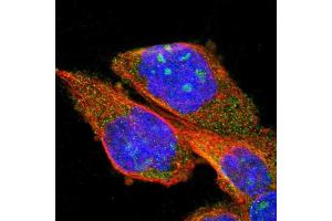 Immunofluorescent staining of human cell line A-431 shows positivity in nucleoli & cytoplasm.
