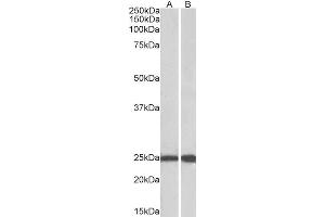 Western Blotting (WB) image for anti-RAN, Member RAS Oncogene Family (RAN) (AA 197-210) antibody (ABIN5876167) (RAN Antikörper  (AA 197-210))