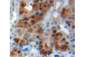 Used in DAB staining on fromalin fixed paraffin-embedded Kidney tissue (PSMC2 Antikörper  (AA 1-433))