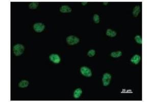 Immunostaining analysis in HeLa cells. (TAF6 Antikörper)