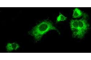 Image no. 2 for anti-Lysyl Oxidase (LOX) (AA 22-168) antibody (ABIN1491219) (LOX Antikörper  (AA 22-168))
