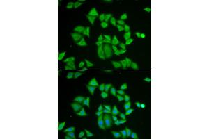 Immunofluorescence analysis of A549 cells using GSTM2 antibody. (GSTM2 Antikörper)