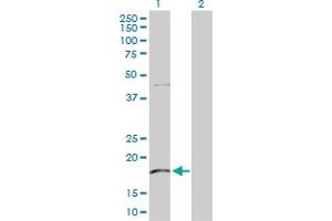 Western Blot analysis of KLRG1 expression in transfected 293T cell line by KLRG1 MaxPab polyclonal antibody. (KLRG1 Antikörper  (AA 1-189))