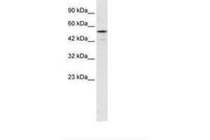 Image no. 1 for anti-Smad Nuclear Interacting Protein 1 (SNIP1) (AA 192-241) antibody (ABIN6735930) (SNIP1 Antikörper  (AA 192-241))
