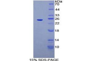 SDS-PAGE analysis of Rat Sprouty Homolog 3 Protein.