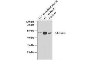 Western blot analysis of extracts of various cell lines using ST3GAL3 Polyclonal Antibody at dilution of 1:1000. (ST3GAL3 Antikörper)