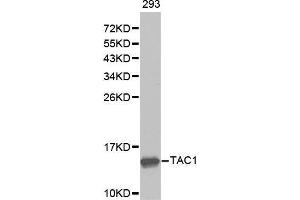 Western blot analysis of extracts of 293 cell lines, using TAC1 antibody. (TAC1 Antikörper  (AA 1-129))