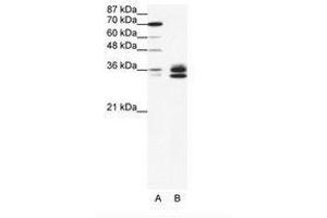 Image no. 1 for anti-Nuclear Factor-kB p65 (NFkBP65) (AA 21-70) antibody (ABIN203274) (NF-kB p65 Antikörper  (AA 21-70))