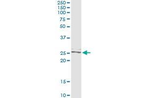 Immunoprecipitation of TWIST2 transfected lysate using anti-TWIST2 monoclonal antibody and Protein A Magnetic Bead , and immunoblotted with TWIST2 MaxPab rabbit polyclonal antibody. (TWIST2 Antikörper  (AA 1-160))