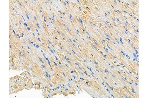 ABIN6260772 and ABIN6266926 at 1/100 staining Mouse heart tissue by IHC-P. (CERKL Antikörper  (Internal Region))