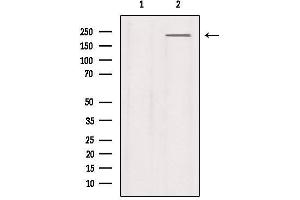 Western blot analysis of extracts from Mouse lung, using Na+ CP type IXalpha Antibody. (SCN9A Antikörper  (Internal Region))
