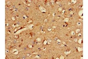 Immunohistochemistry of paraffin-embedded human brain tissue using ABIN7146282 at dilution of 1:100 (RCAN2 Antikörper  (AA 88-197))