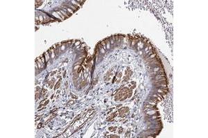 Immunohistochemical staining of human bronchus with C11orf60 polyclonal antibody  shows moderate cytoplasmic and membrane positivity in respiratory epithelial cells at 1:500-1:1000 dilution. (IFT46 Antikörper)