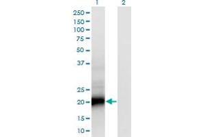 Western Blot analysis of SMUG1 expression in transfected 293T cell line by SMUG1 monoclonal antibody (M07), clone 4D5. (SMUG1 Antikörper  (AA 1-177))