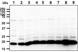 The cell lysates (40ug) were resolved by SDS-PAGE, transferred to PVDF membrane and probed with anti-human SSU72 antibody (1:1000). (SSU72 Antikörper)