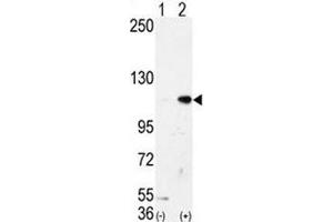 Western blot analysis of LSD1 antibody and 293 cell lysate either nontransfected (Lane 1) or transiently transfected with the AOF2/LSD1 gene (2). (LSD1 Antikörper  (AA 108-142))