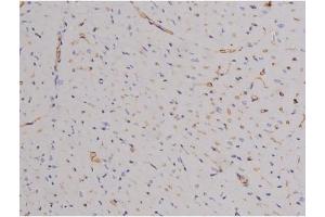 Immunohistochemistry (IHC) image for anti-PTK2 Protein tyrosine Kinase 2 (PTK2) (pTyr576) antibody (ABIN6256766)