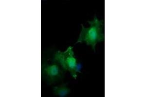 Image no. 4 for anti-HRas proto-oncogene, GTPase (HRAS) antibody (ABIN1498716) (HRAS Antikörper)