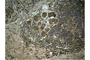 Immunohistochemistry (IHC) image for anti-Histone Cluster 1, H3a (HIST1H3A) (H3K27me3) antibody (ABIN7139677)