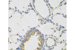 Immunohistochemistry of paraffin-embedded Rat lung using PON2 Polyclonal Antibody at dilution of 1:100 (40x lens).