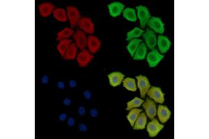 ABIN6260161 and ABIN6279063 staining Hela cells by IF/ICC. (AWAT2 Antikörper  (Internal Region))