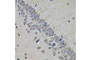 Immunohistochemistry of paraffin-embedded rat brain using NAA50 Antibody. (NAA50 Antikörper  (AA 1-169))