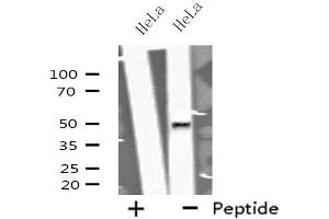 Western blot analysis of extracts from HeLa cells using GORASP2 antibody. (GORASP2 Antikörper  (Internal Region))