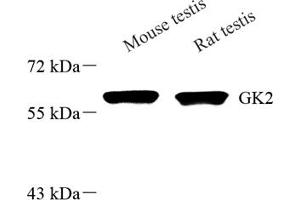 Western blot analysis of GK2 (ABIN7074096) at dilution of 1: 1000 (GK2 Antikörper)