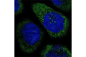 Immunofluorescent staining of human cell line A-431 shows positivity in cytoplasm.